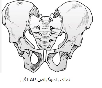 نمای رادیوگرافی AP لگن